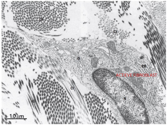 <ul><li><p>fibroblast</p><ul><li><p>talrijke onregelmatige cytoplasma-uitlopers</p></li><li><p>kern = ovaal, groot, licht, gekleurd met fijn verdeeld chromatinepatroon &amp; grote nucleolus</p></li><li><p>cytoplasma: rijk aan ruw ER &amp; goed ontwikkeld Golgi-apparaat, mitochondriën zijn slank</p></li></ul></li><li><p>fibrocyt</p><ul><li><p>kleiner dan de fibroblast</p></li><li><p>minder cytoplasma-uitlopers</p></li><li><p>kern = langwerpig, kleiner &amp; donkerder gekleurd</p></li><li><p>cytoplasma: weinig ontwikkeld ruw ER &amp; Golgi-apparaat</p></li></ul></li></ul><p></p>