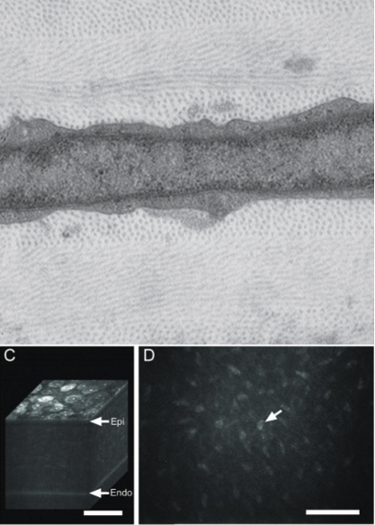 <p>They do scatter light, but minimizes it by having thin cytoplasm and express large quantities of crystallin protein in the thin cytoplasm </p>