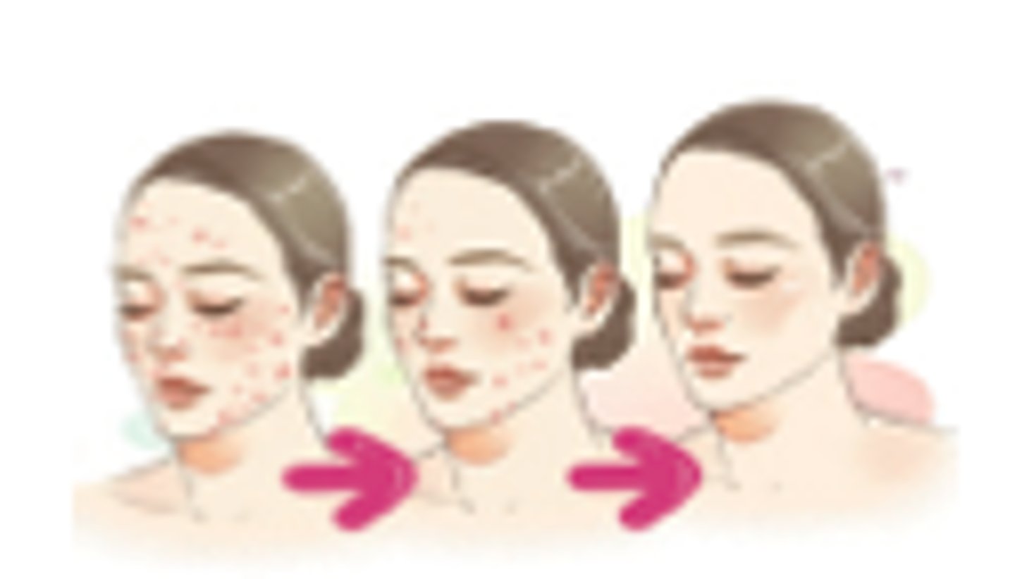 <p>To be improved, advanced (좋아지다)</p>