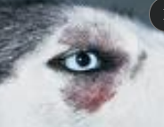 <p><span>Zinc-Responsive Dermatosis</span></p>