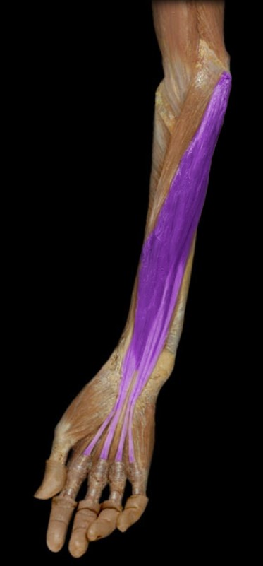 <p>Name the muscle highlighted (three words - all lowercase)</p>