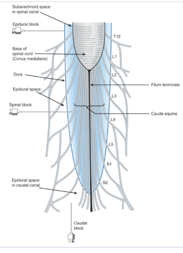 used for labor and some surgical procedures 

allows for catheter placement and repeat infusions 

most significant effects on nerve roots near infusion site