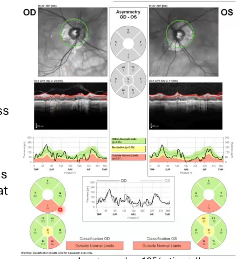 <p>unusual disc </p>