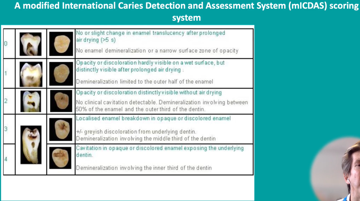 <p>modified ICDAS scoring system </p>