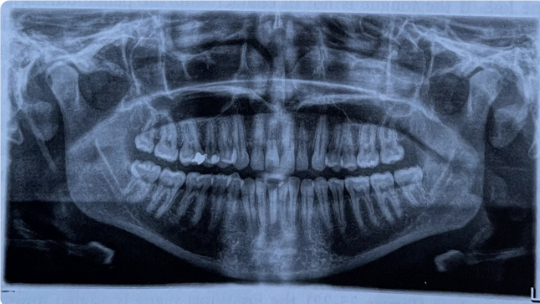 term image