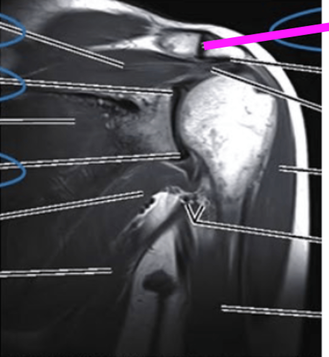 <p>what does the pink line point to?</p>