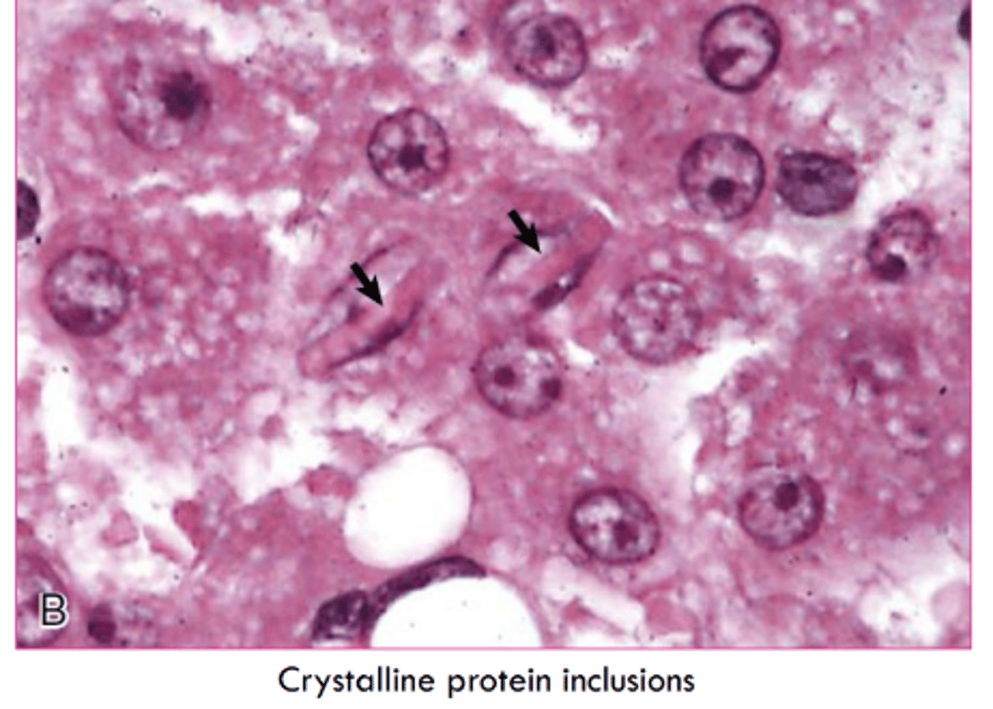 <p>age</p><p>hepatocytes and rental tubular epithelial cells</p>