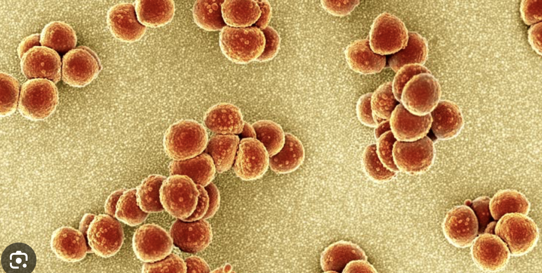 <p>What is the shape of this bacteria</p>