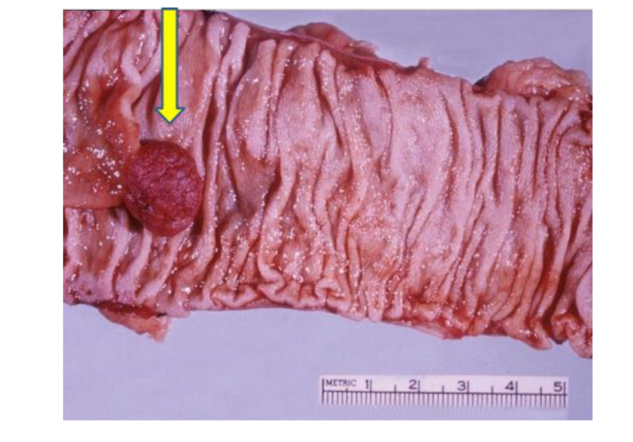 <p>Identify</p>