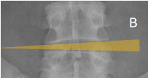 <p>Q what position is the spine in here?</p>