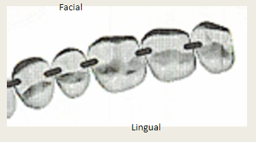 <p>Have contact areas located more facially when you look at them in an occlusal view. </p>