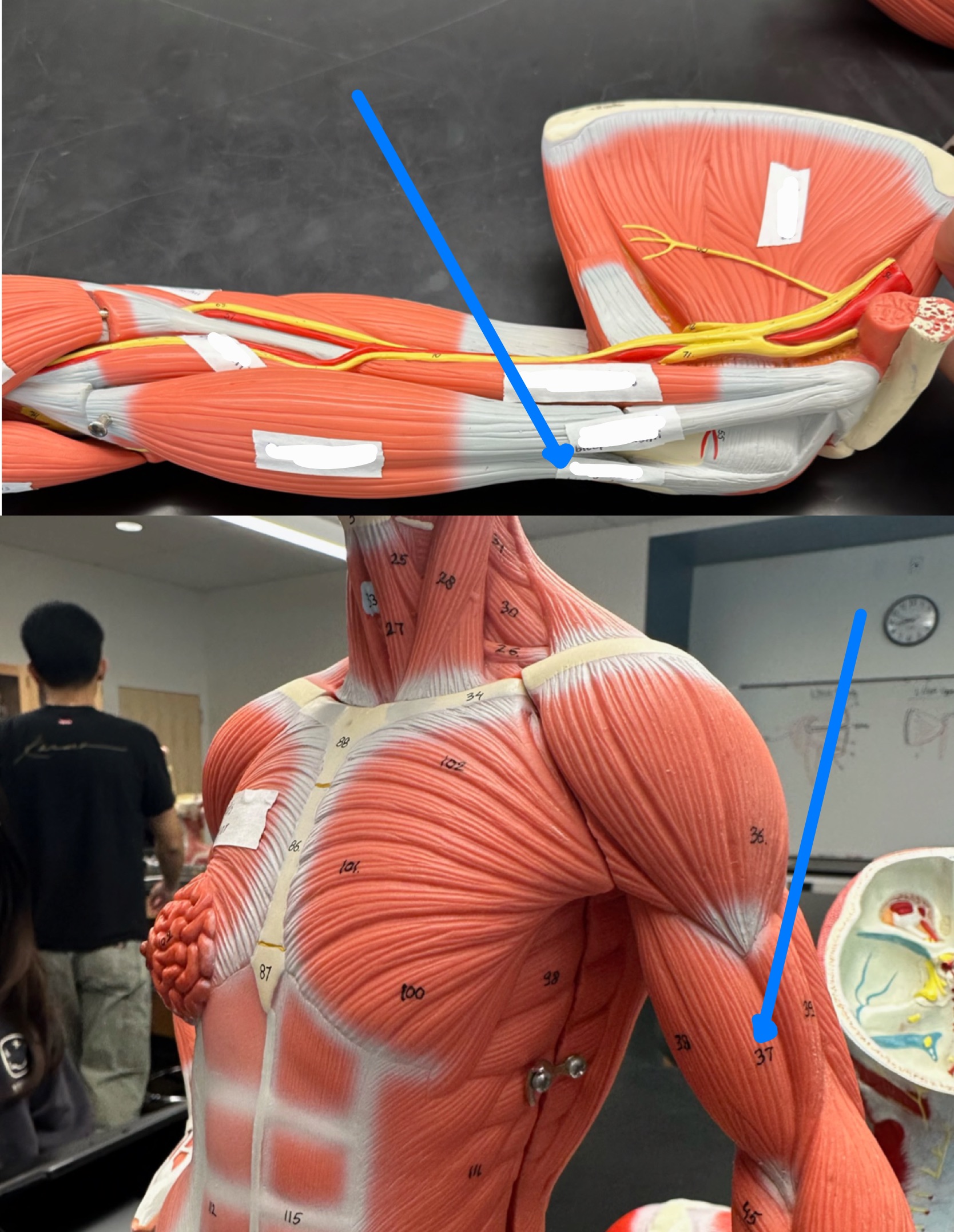 <p>ID muscle </p>
