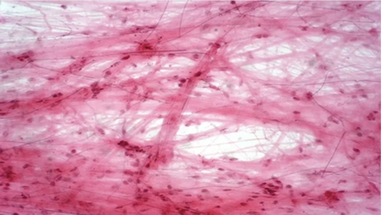 <p>The connective tissue provides support for the body and helps to hold all the body parts together. The cells in the tissue are not close together. They are seperate from each other by large amounts of material that is not made of cells. This non cellular material is called the matrix. Connective tissue include bone, cartilage, tendon, ligaments and fat storage tissues. Blood is often classified as a connective tissue. The matrix in blood is the liquid in which blood cells are suspended</p>