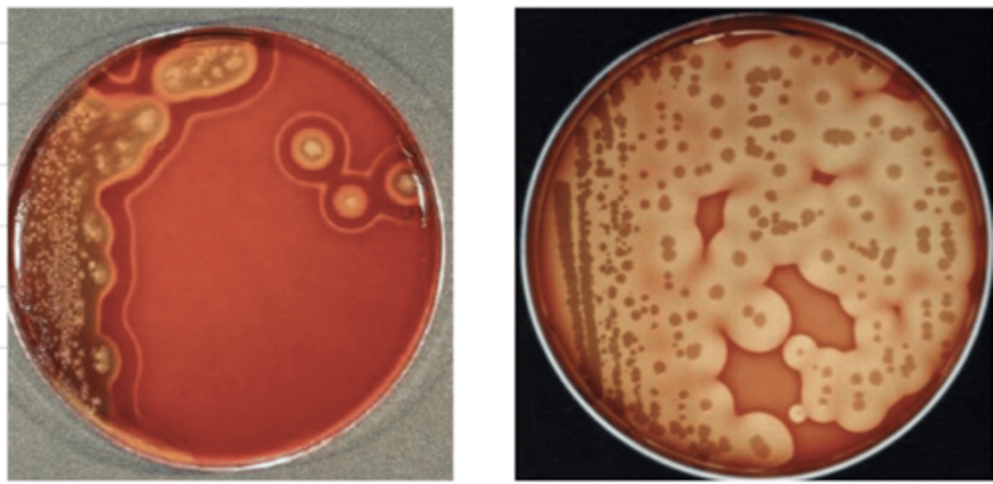 <p>which bacteria produces this result in blood agar?</p>