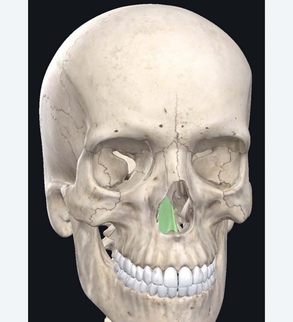 term image