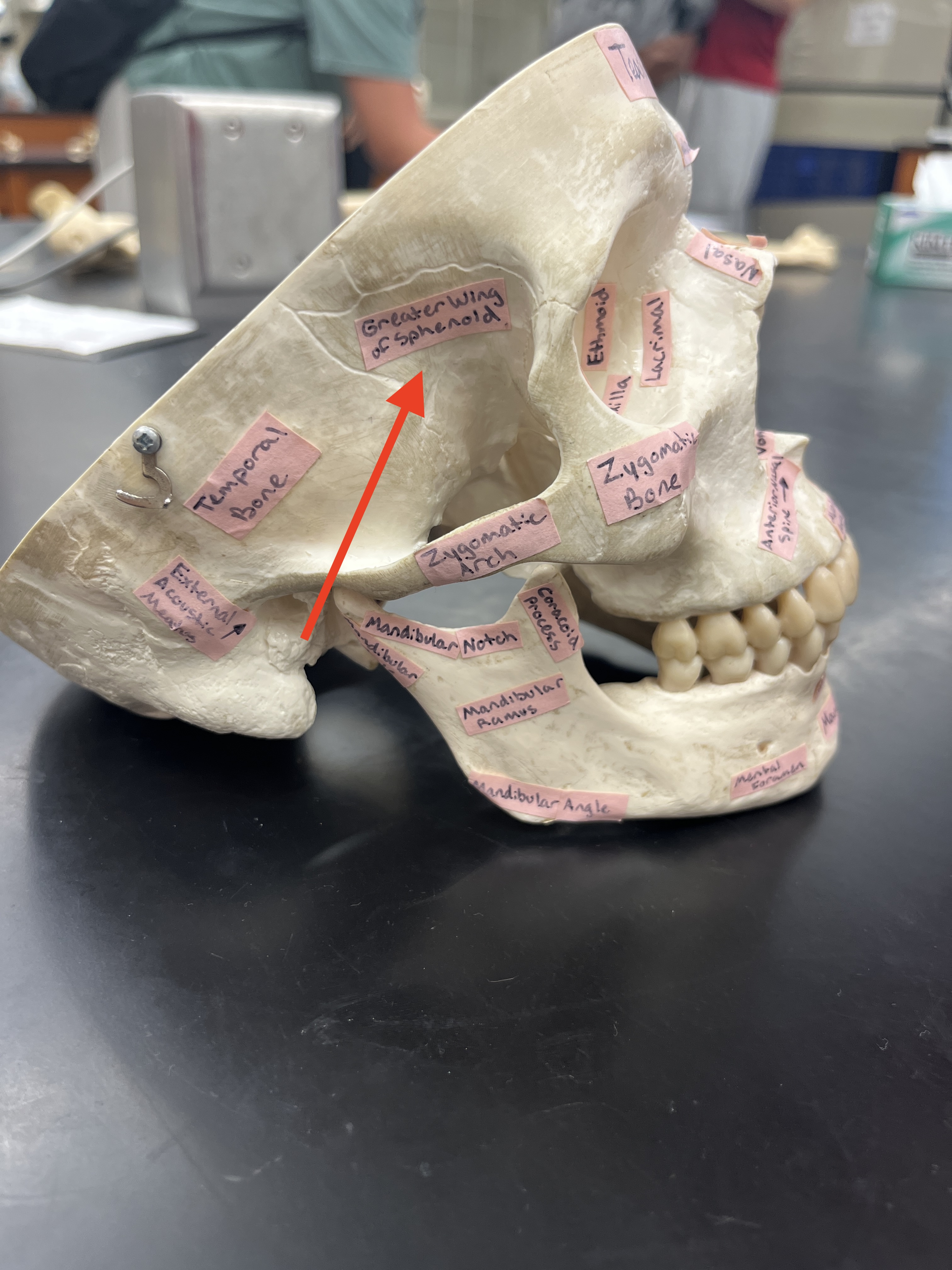 <p>connects face, looks like a bat</p>