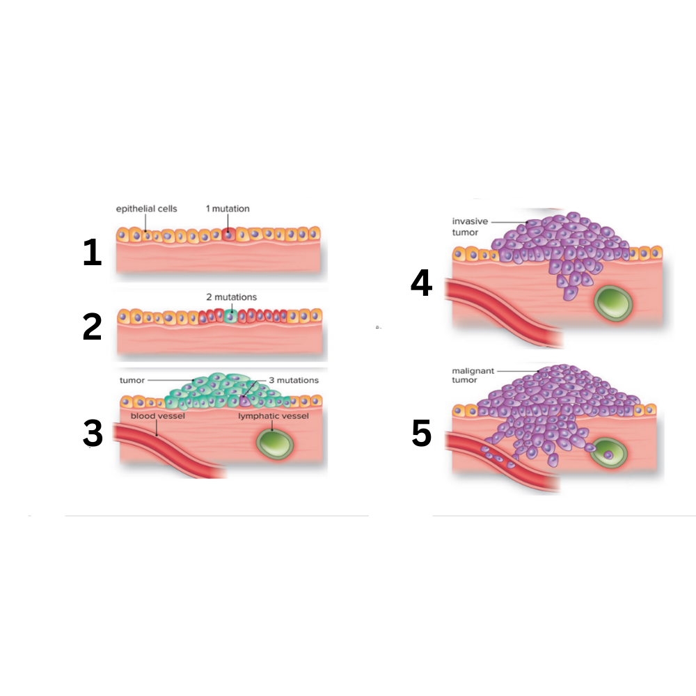 <p>What is happening in no. 2? Assume the teal cell is the start of a tumor</p>