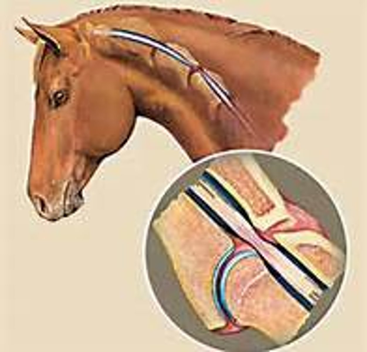 <p>Compression of spinal cord in neck region</p><p>Identified between birth and 4 y.o</p><p>Incoordination begins in hindlimbs and becomes worse</p><p>True wobblers will not improve</p><p>May be genetic</p><p>Can be caused by equine degenerative myeloencephalopathy or deficiency of vitamin E during rapid growth phase</p>
