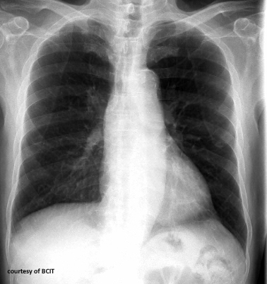 <p>What are the two main functions of the thoracic cage?</p>