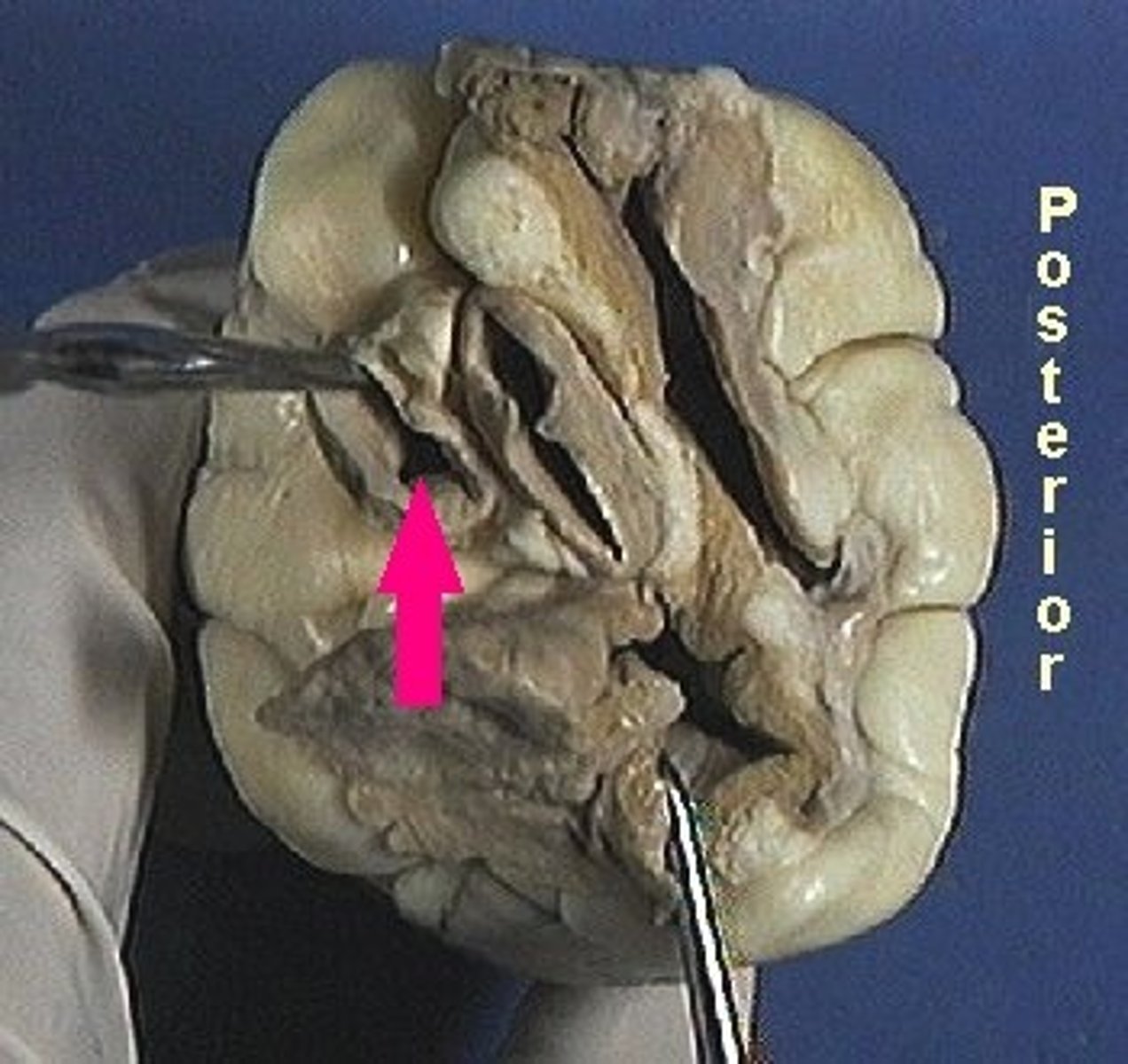 <p>Identify the blood vessel that carries blood from the right ventricle to the lungs</p>
