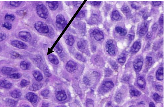 <p>huidepitheel: wat w aangeduid</p>