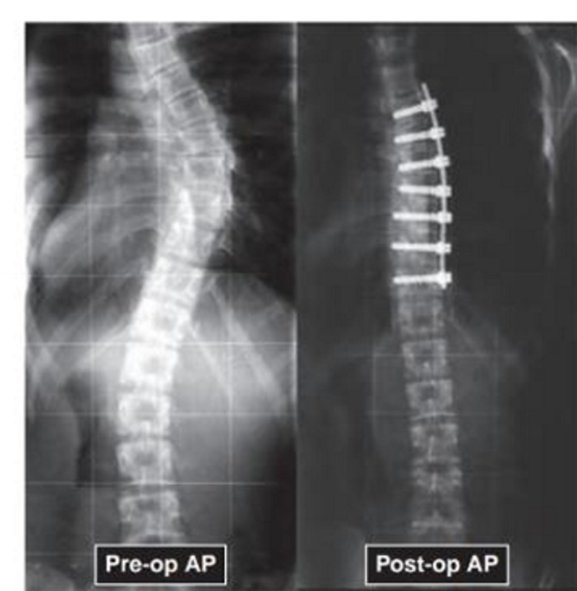 <p>Name the pathology</p>