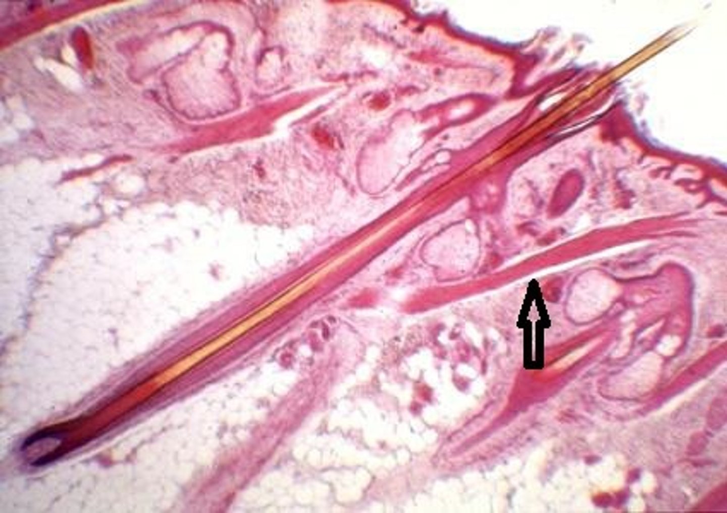 <p>Epithelial and dense connective tissue separated in different zones. Blood vessels are provided.</p>