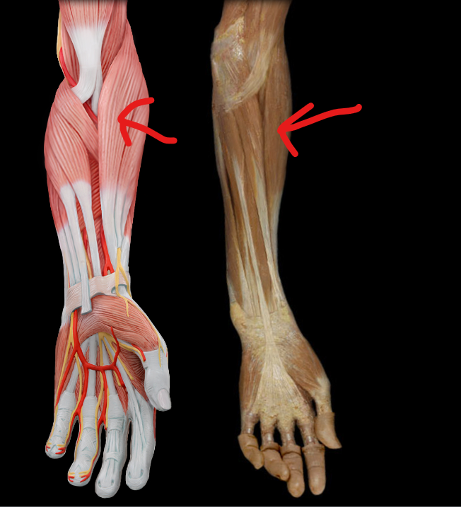 term image