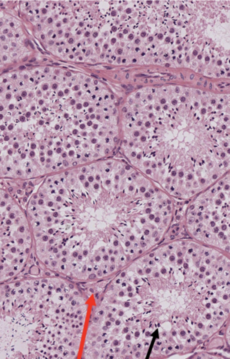 <p>What has the following characteristics:</p><p>- Spermatogenic (aka germinal, seminiferous) epithelium</p><p>- - Spermatogenic cells</p><p>- - Sertoli (supporting) cells</p>