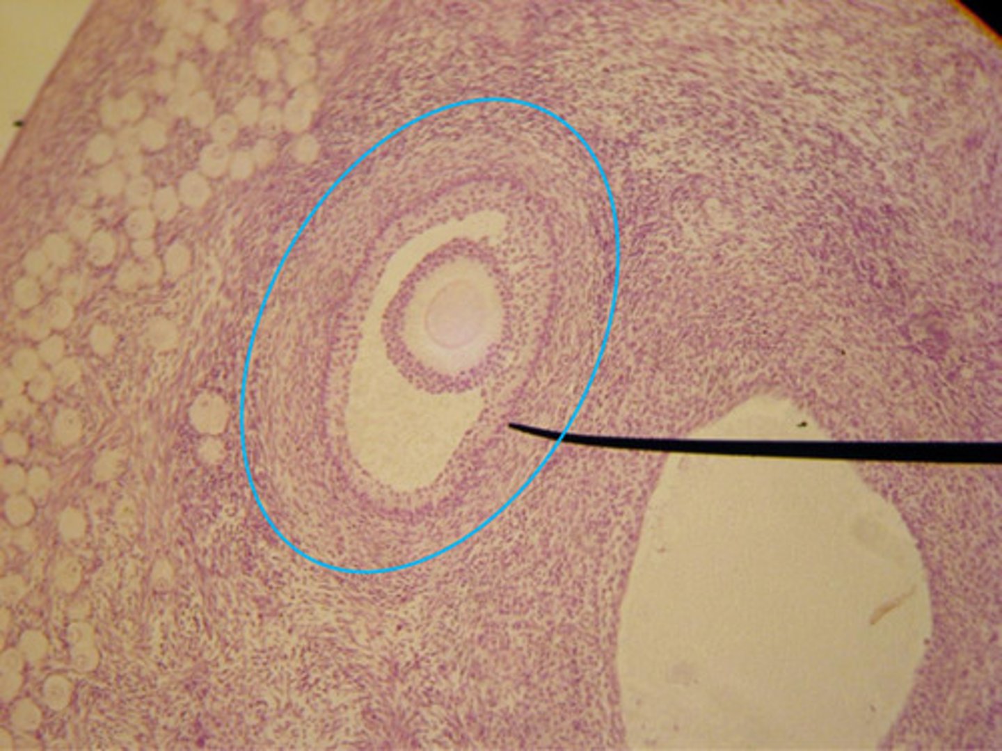 <p>- 2 layers</p><p>- No antrum</p><p>- Large oocyte</p>