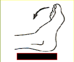 <p>What Movement is occurring?</p>