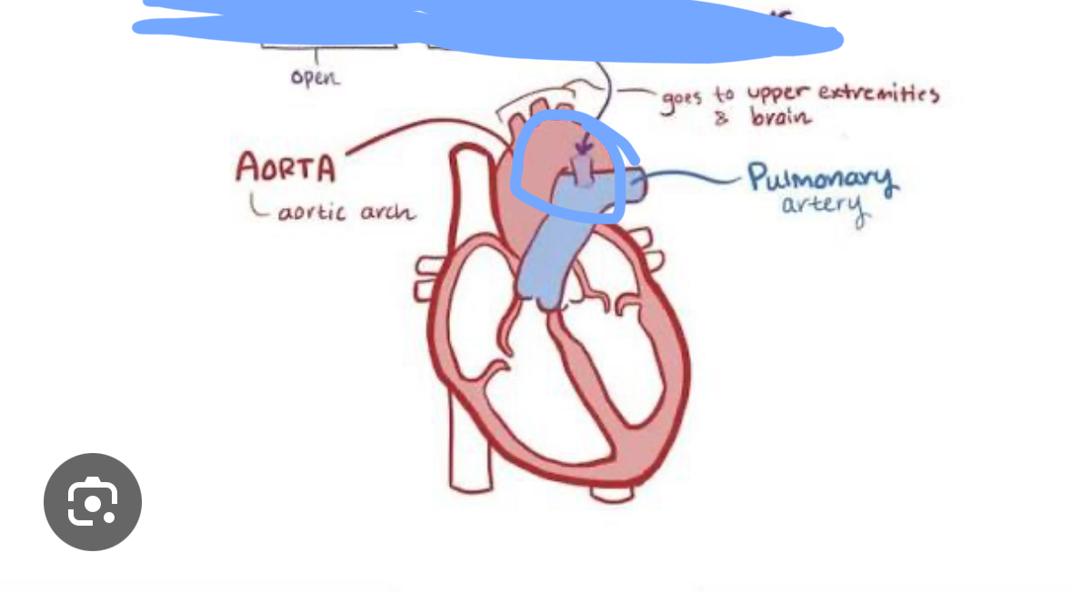 <p>Fetal vessel that bypasses the lungs</p>