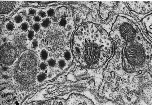 <p>Storage of peptides in secretory granules (conditions determine the processing of the peptide hormones)</p>