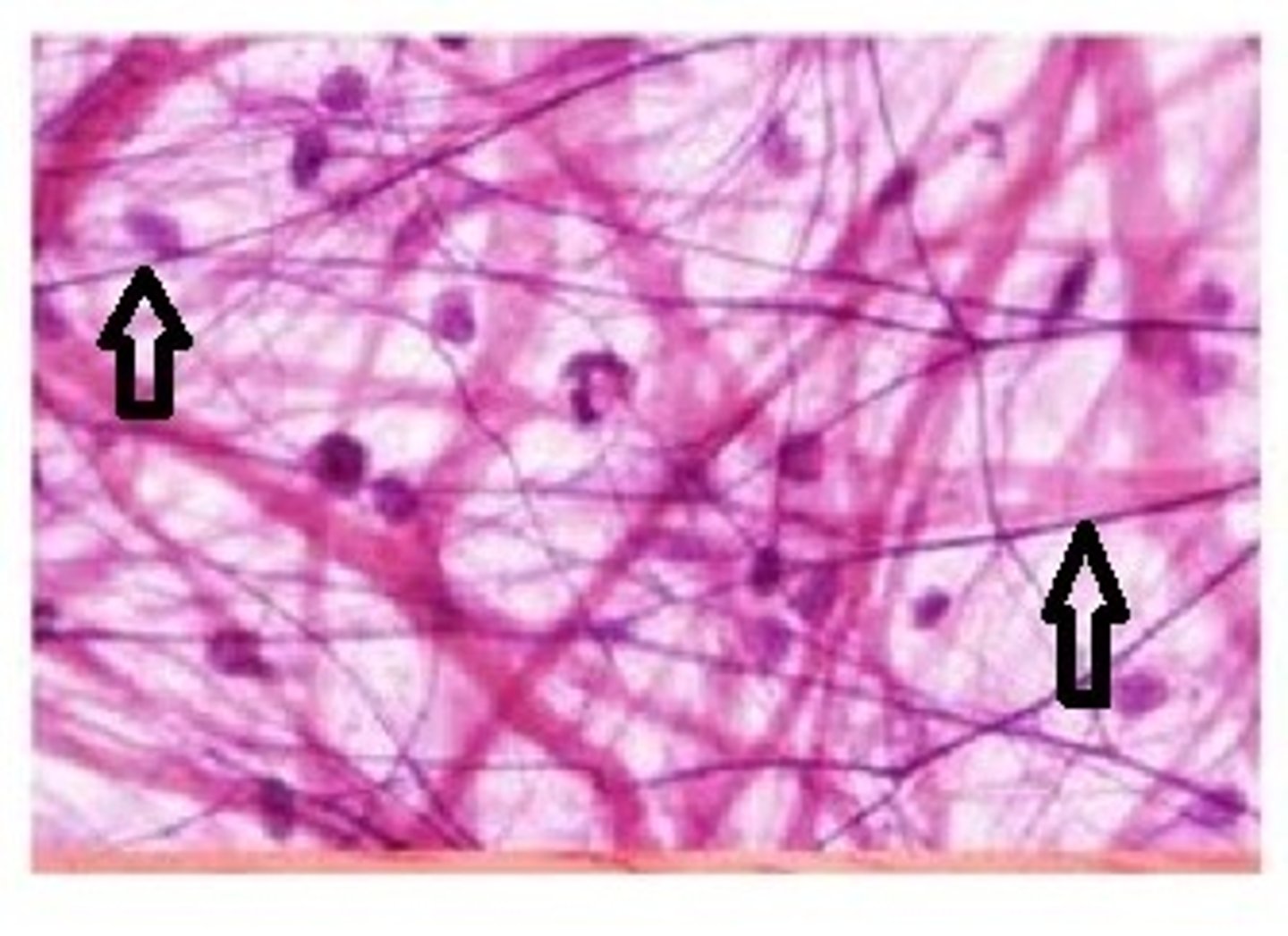 <p>thinner, not as strong as collagen fibers, randomly coiled, wavy look; dark purple on slide</p>