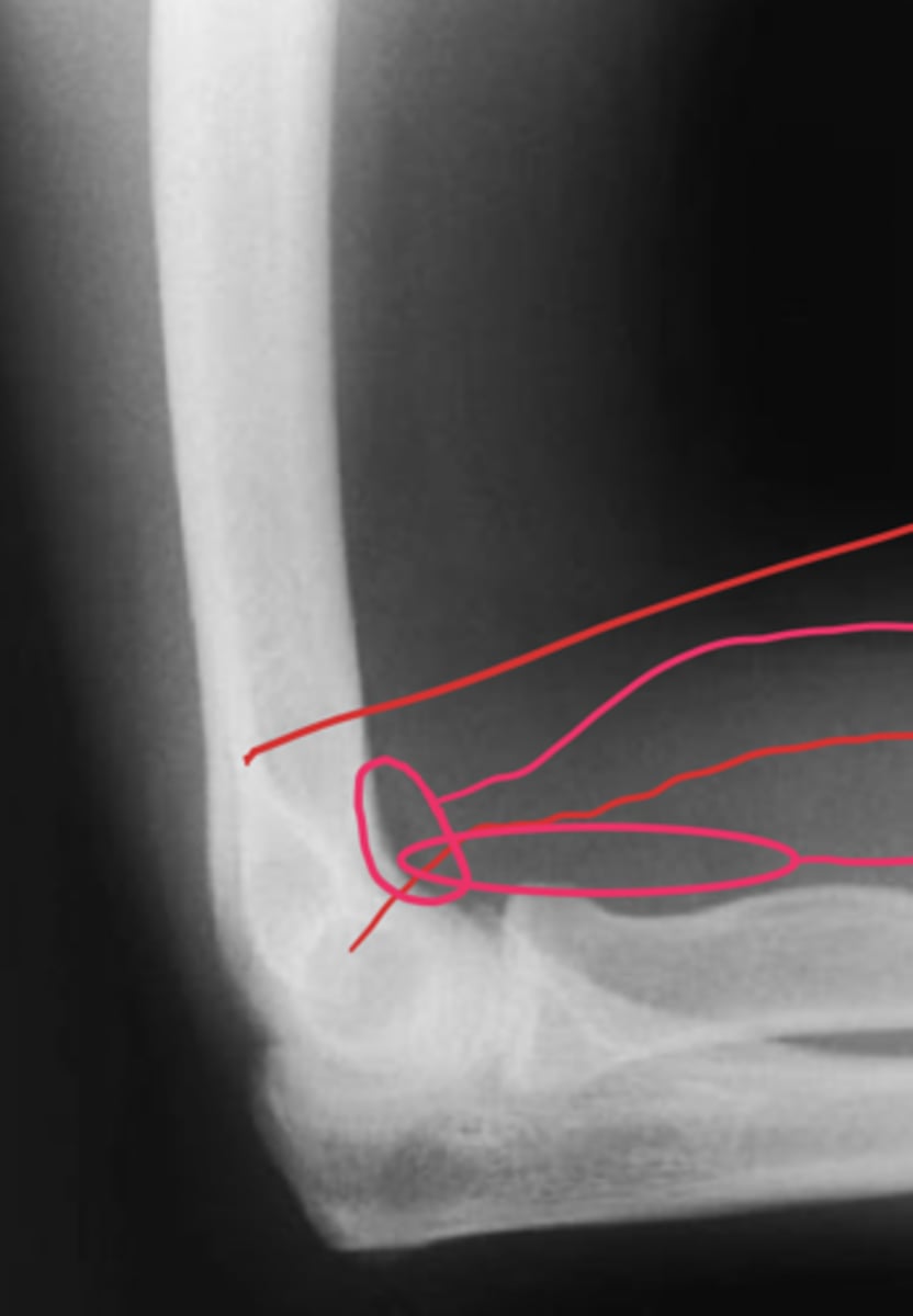 <p>What view is this?</p>