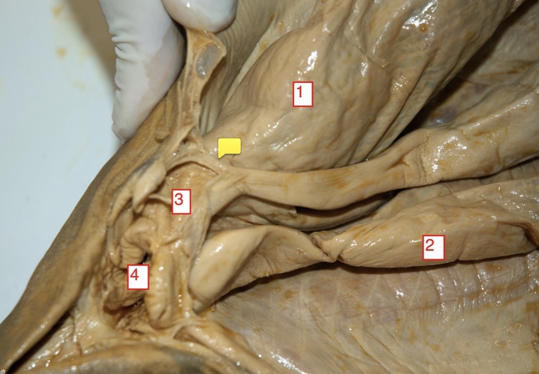 <p>female spiny dogfish- (2)</p>