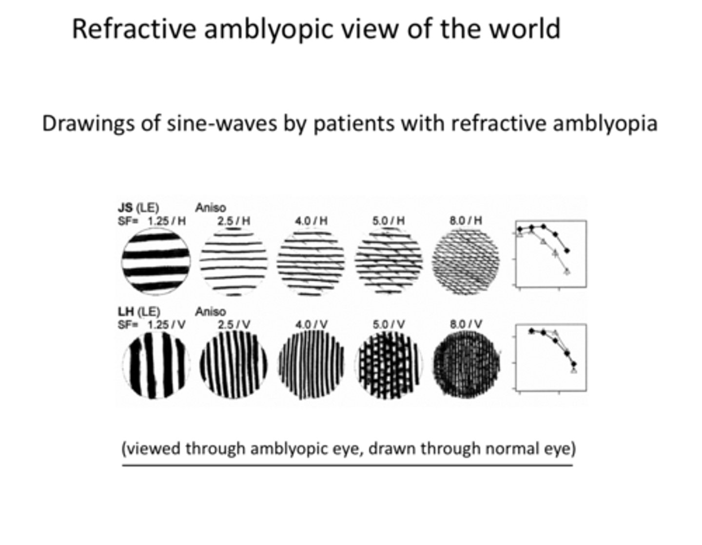 <p>Drawings of Sine Waves by Patients with Refractive Amblyopia (Pic)</p>