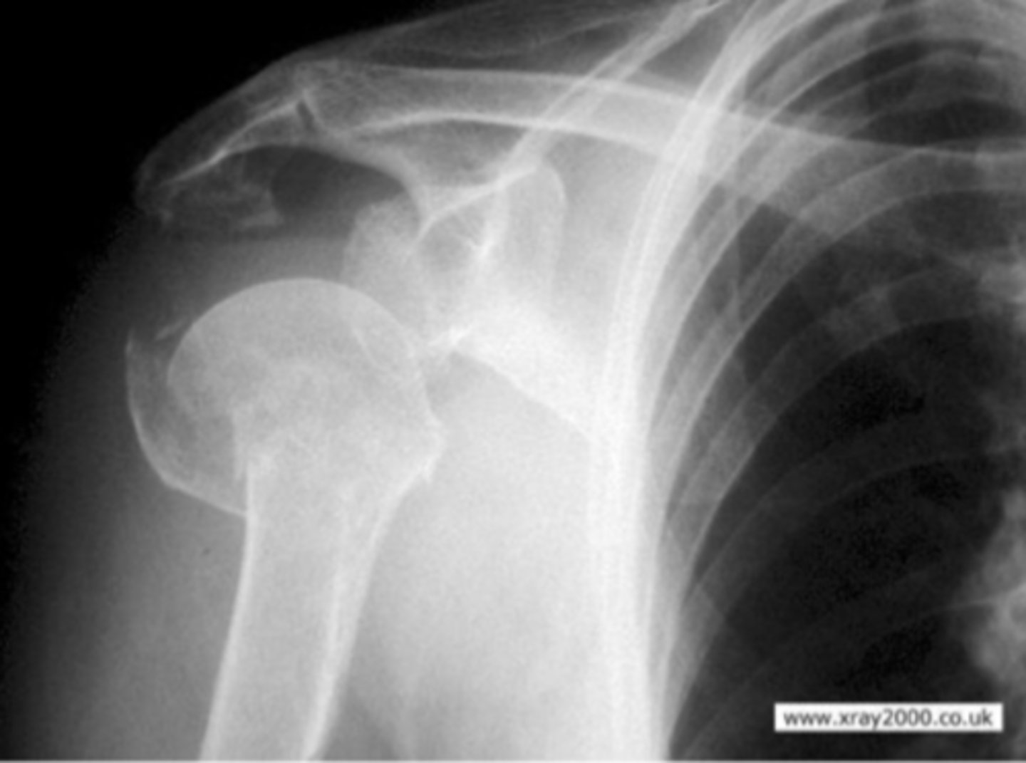 <p>What is the issue?</p>