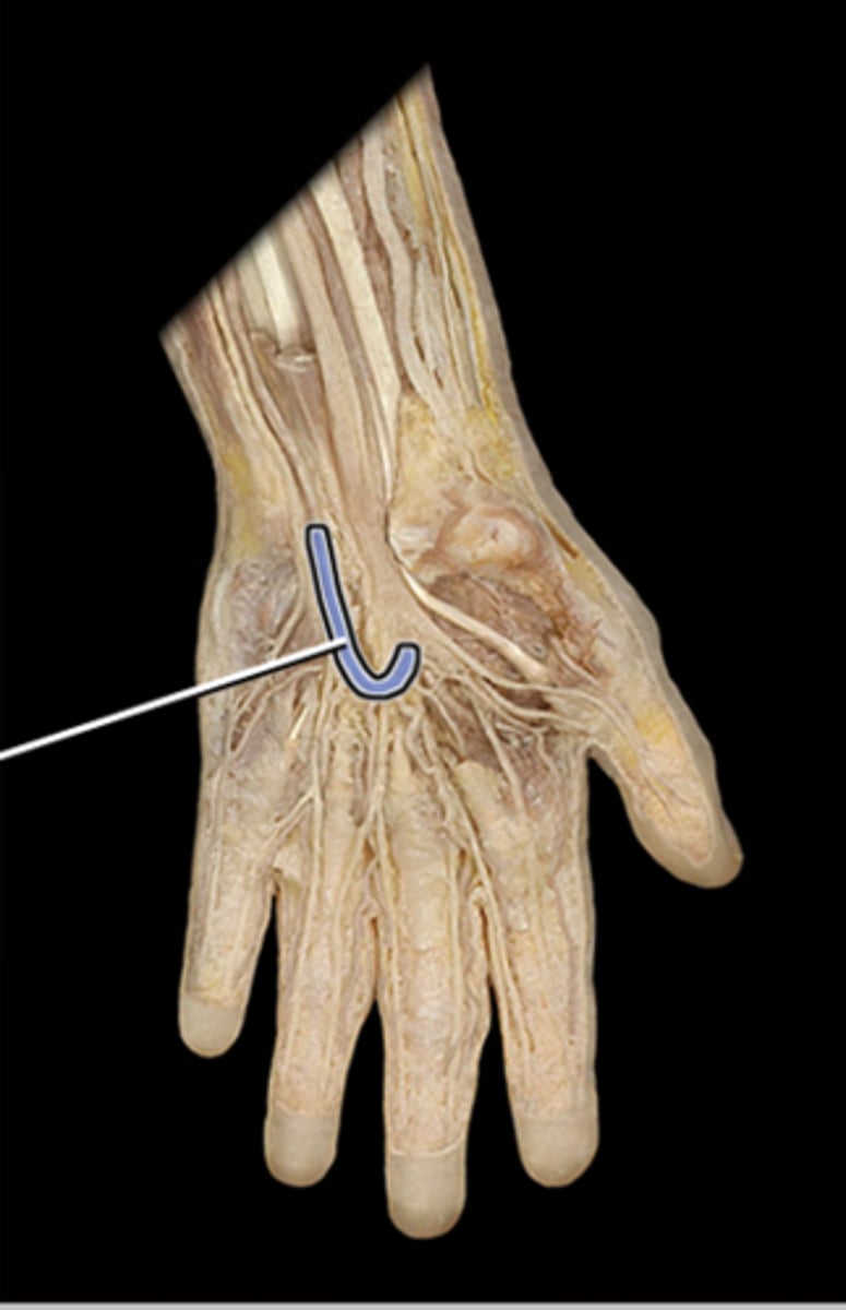 <p>Supplies blood to the palmar aspect of metacarpals and digits</p>