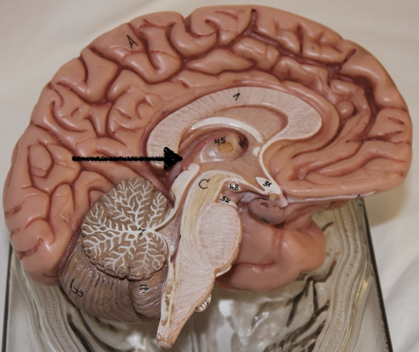 <p>identify this part of the brain</p>