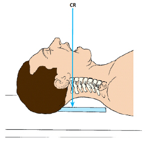 <p><span>The x-ray projection demonstrated in this figure is the:</span></p>