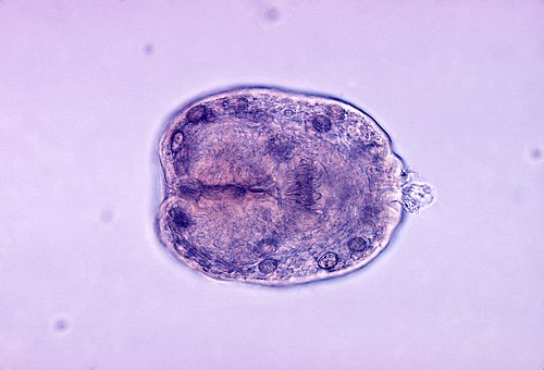 <p>Tapeworms that cause Hydatidosis, transmitted via ingestion of eggs from contaminated environments, leading to cyst formation in various organs.</p>