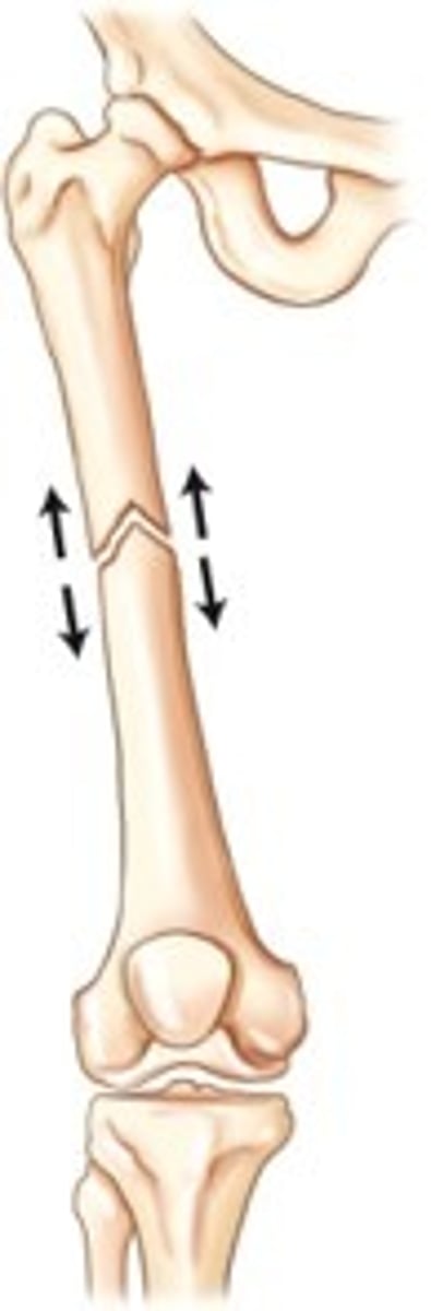 <p>ends pulled apart &amp; not making contact</p>