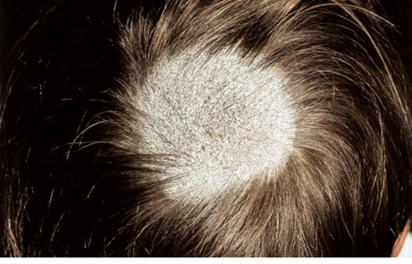 <p>scientific study of hair and its diseases and care.</p>