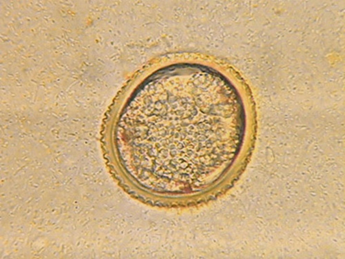 <p>Female gamete providing nutrients for embryo.</p>