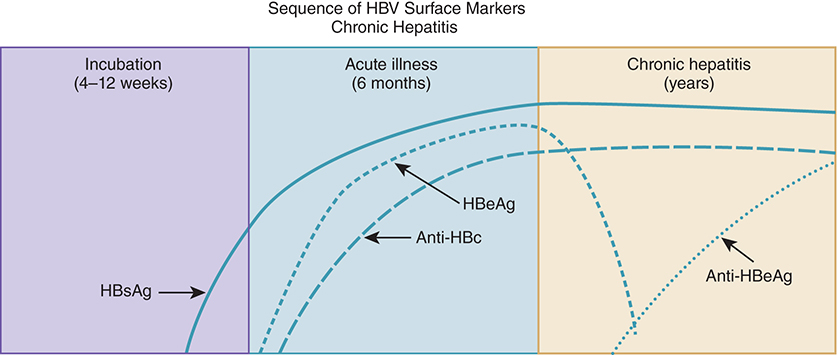<ul><li><p class=""><strong>HBsAg persists &gt;6 months</strong> → chronic HBV</p></li><li><p class=""><strong>HBeAg may persist</strong> (<span style="color: red">poor prognosis</span>) or <strong>decline</strong> with <strong>Anti-HBe formation</strong> (better outcome)</p></li><li><p class=""><span style="color: red"><strong>No Anti-HBs</strong> formed in chronic infection</span></p></li><li><p class=""><span style="color: #be4949"><strong>Anti-HBc</strong> (total) stays positive regardless of chronicity</span></p></li></ul><p class=""></p><p class="">Just know general trends</p><p></p>