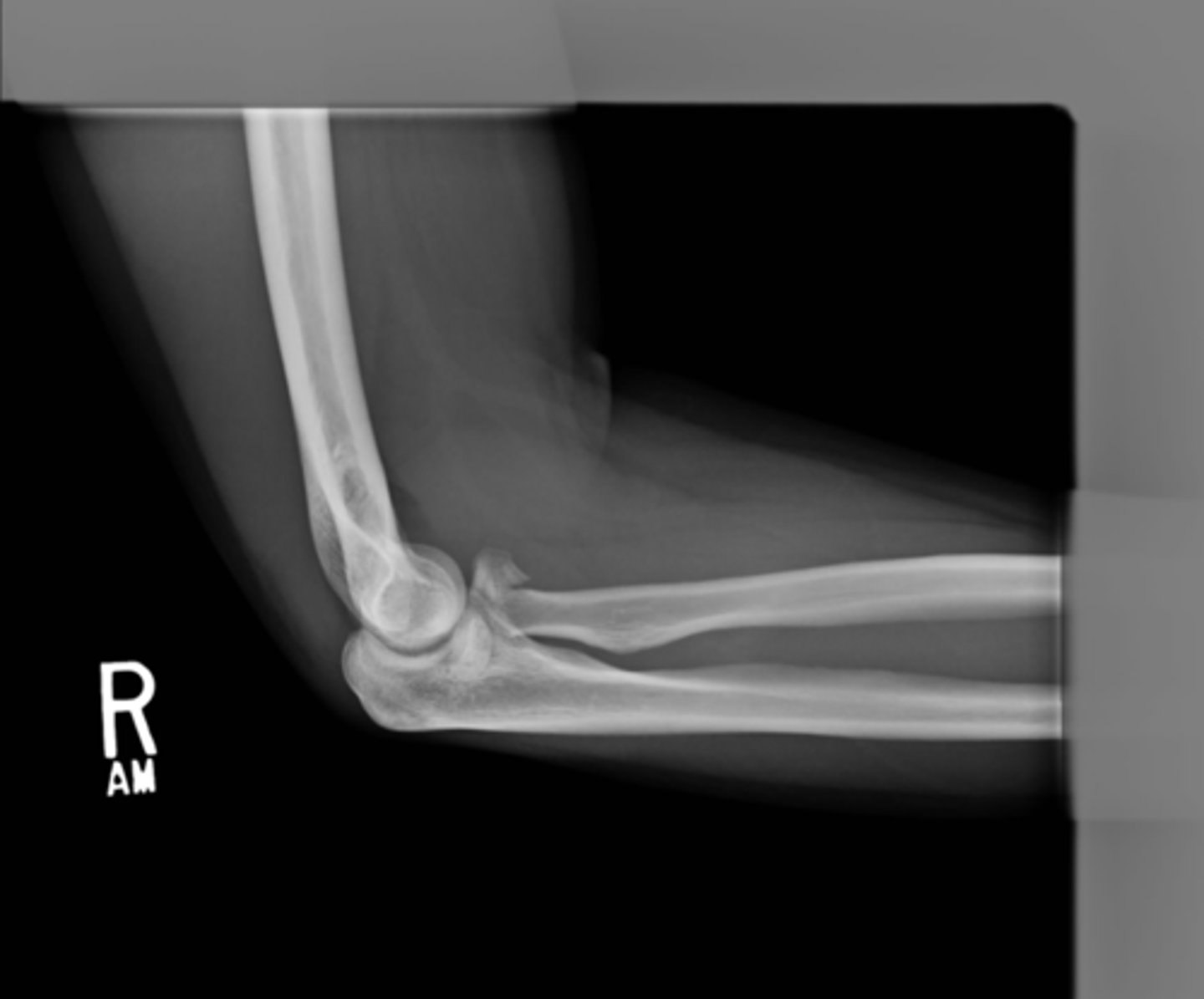 <p>- Diagnose the physical characteristics of the fracture or dislocation</p><p>- To assess and monitor the results of treatment</p>