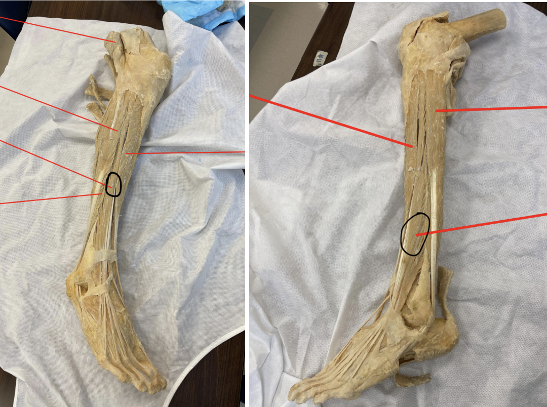 <p>identify + state origin, insertion, action, innervation of marked structure</p>