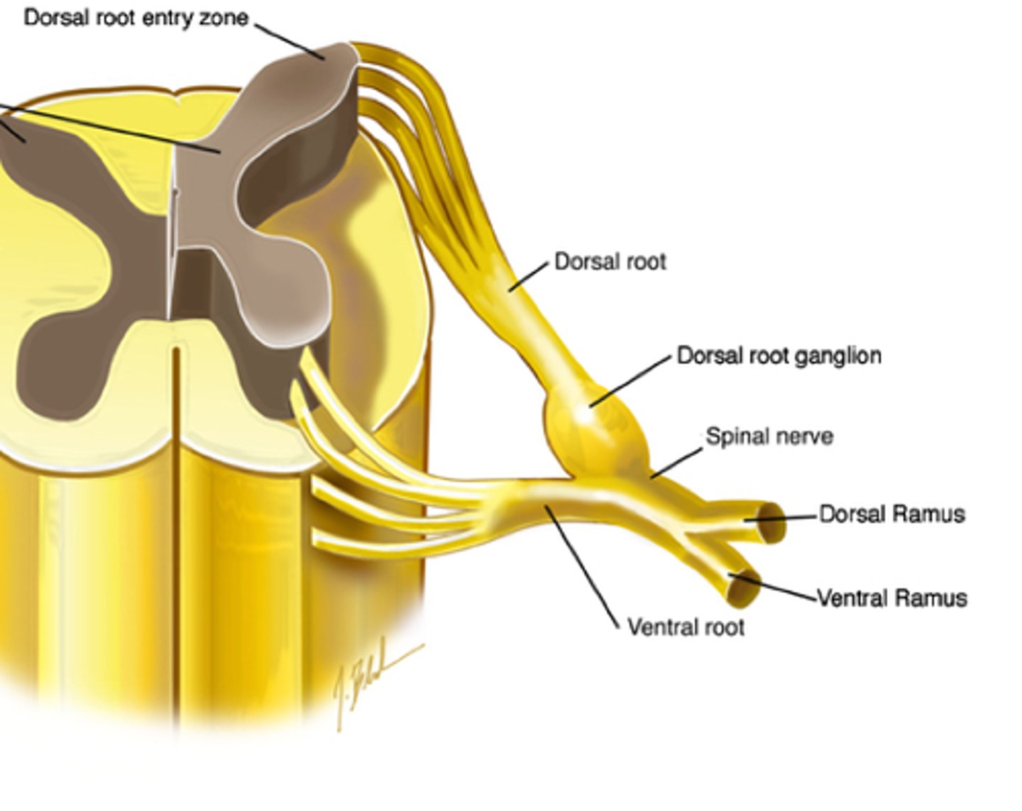 <p>motor AND sensory loss</p><p>- ventral ramus - motor and sensory loss of anterolateral trunk and limbs</p><p>- dorsal ramus - motor and sensory loss of back</p>
