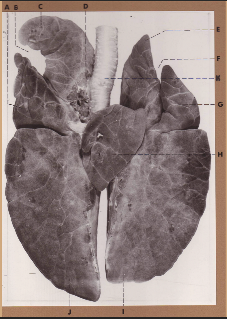 <p>D </p><p>(pig lungs, ventral)</p>
